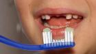 Започна кампания за профилактика на детските зъби в Перник 09_1474000052