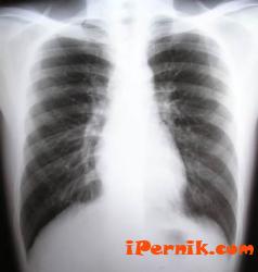 Нови случаи на туберкулоза в Перник 06_1370509587