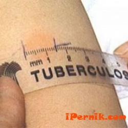 Регистрираха случай на туберколоза от Долни Раковец 05_1432137974